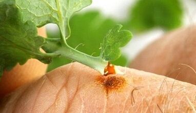 How do you get a wart with a celandine