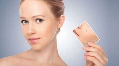 review of effective drugs for warts and papillomas